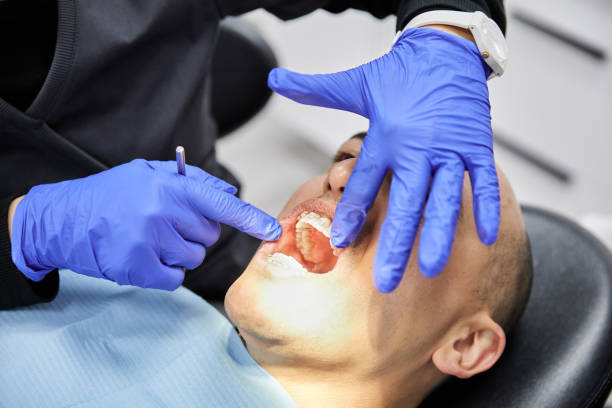 Best Emergency Dentist for Knocked-Out Tooth in Buchanan Dam, TX